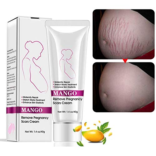 Remove Pregnancy Scars Cream - Mango Flavor 40g