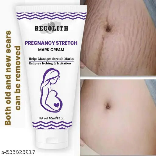 Advanced Stretch Mark Repair Cream – Intensive Body Firming & Scar Therapy